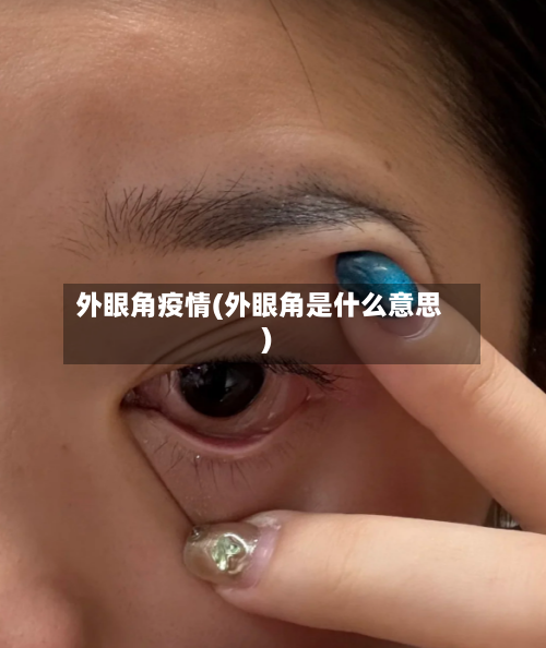 外眼角疫情(外眼角是什么意思)-第2张图片