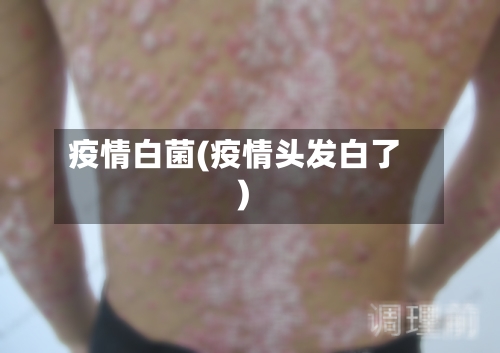 疫情白菌(疫情头发白了)-第2张图片