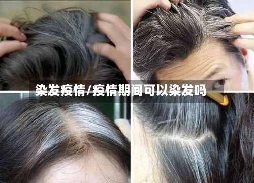 染发疫情/疫情期间可以染发吗